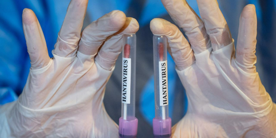 İlaç Firmaları Hantavirüs Aşısı İçin Çalışmalara Başladı
