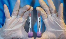dso-hantavirus-salgininda-sona-gelindi-1782726899
