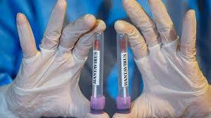 dso-hantavirus-salgininda-sona-gelindi-1782726899
