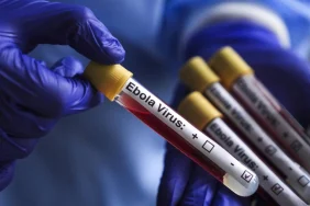 kongo-da-ebola-salgini-vaka-sayisi-1155-e-yukseldi-1782474244
