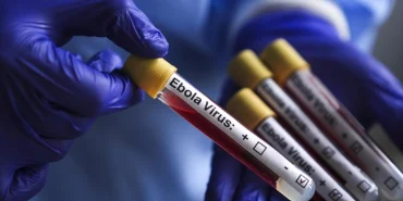kongo-da-ebola-salgini-vaka-sayisi-1155-e-yukseldi-1782474244