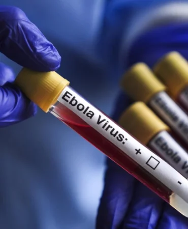 kongo-da-ebola-salgini-vaka-sayisi-1155-e-yukseldi-1782474244